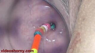 Проникновение в матку предметами, накачивание пролапса шейки матки - порно видео